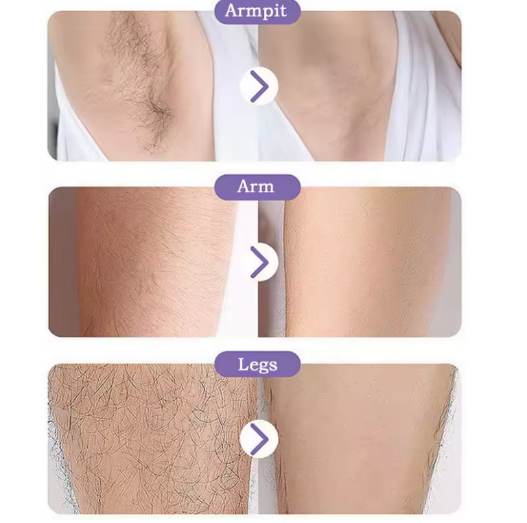 Pijnloze Nano-Epilator